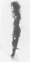 255