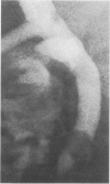 255