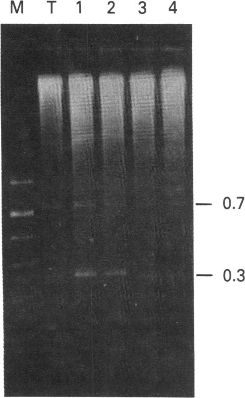 graphic file with name pnas00633-0040-a.jpg