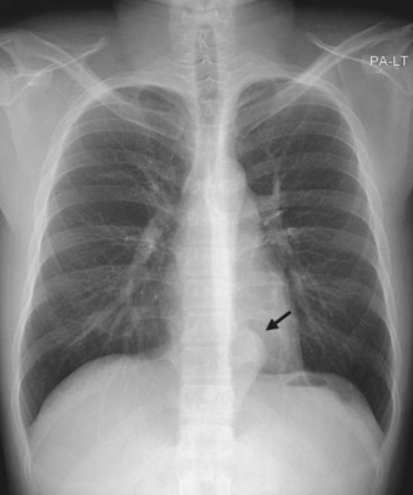 Fig. 1
