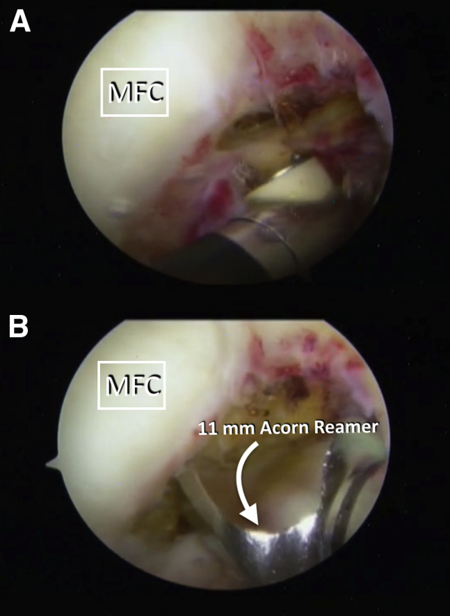 Fig 7