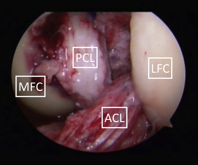 Fig 11