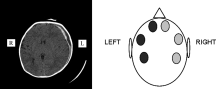 FIG. 2.