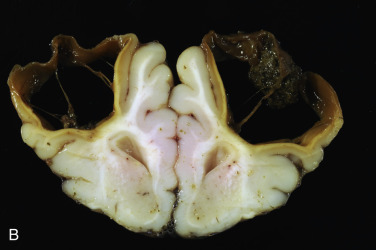 Figure 4-36