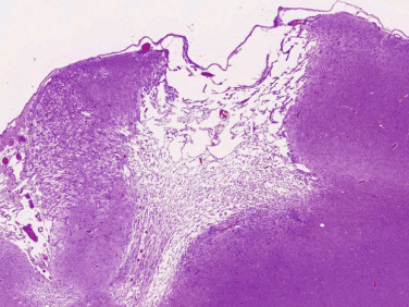 Figure 4-55
