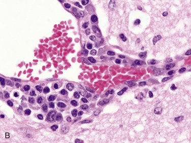 Figure 4-17