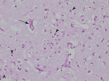 Figure 4-66