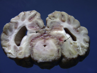 Figure 4-97
