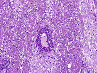 Figure 4-51
