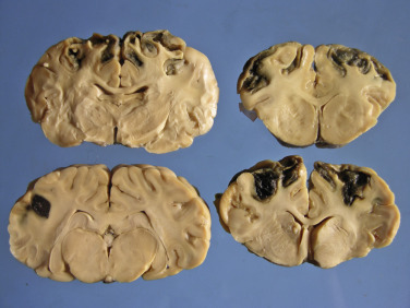 Figure 4-111