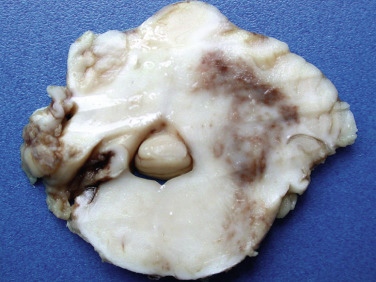 Figure 4-125