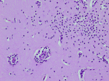 Figure 4-108