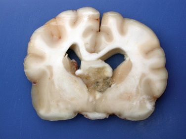 Figure 4-135