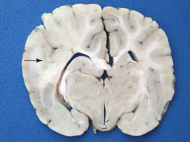 Figure 4-122