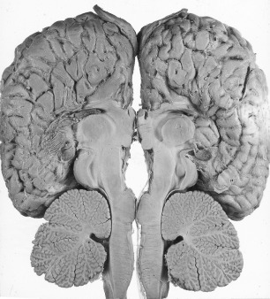 Figure 4-21