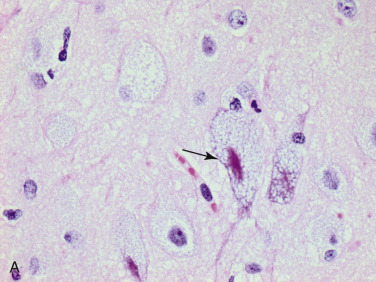 Figure 4-37
