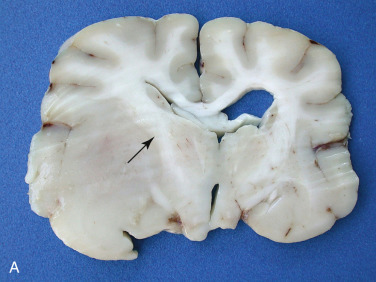 Figure 4-131