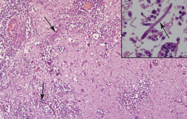 Figure 4-121