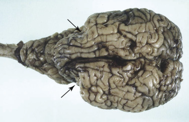 Figure 4-30