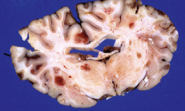 Figure 4-100