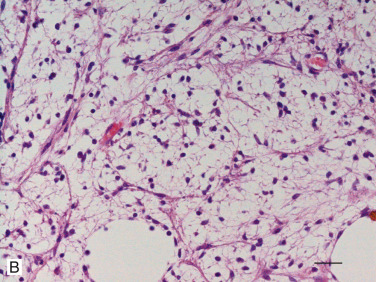 Figure 4-141