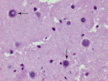 Figure 4-5