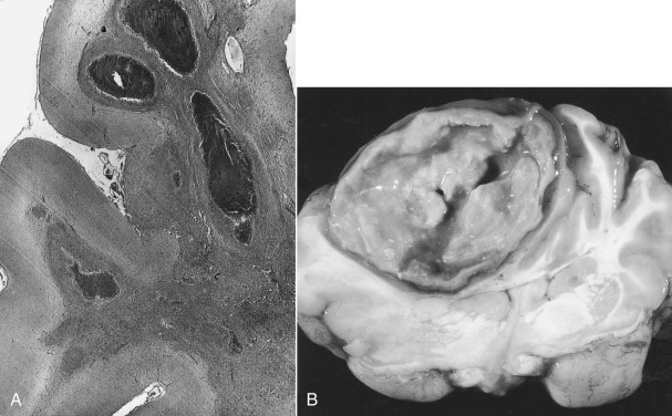 Figure 4-93
