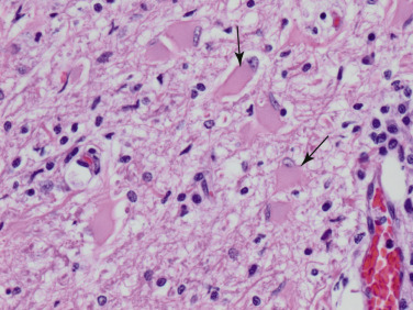 Figure 4-13
