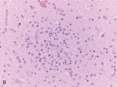 Figure 4-107