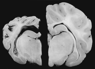 Figure 4-42