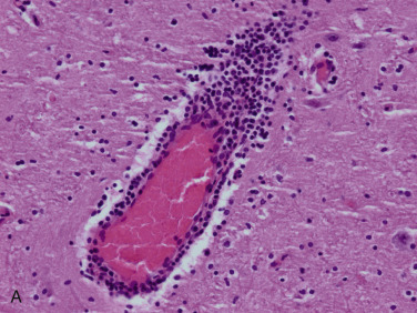 Figure 4-17