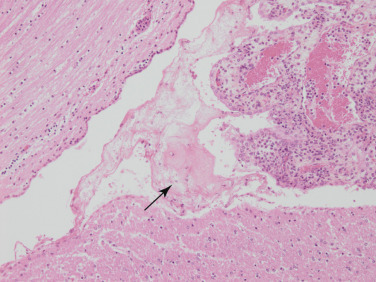 Figure 4-44