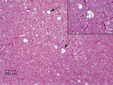 Figure 4-3