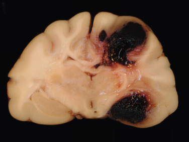 Figure 4-57