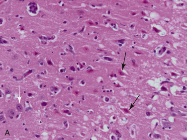 Figure 4-2