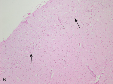 Figure 4-65