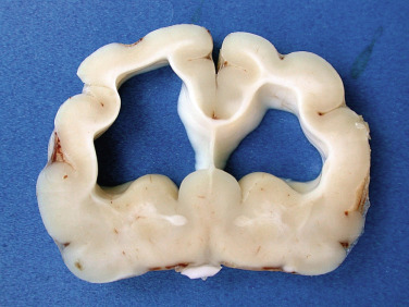 Figure 4-23