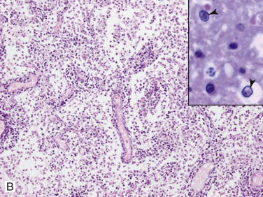 Figure 4-112