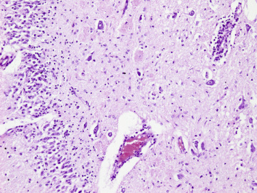 Figure 4-109