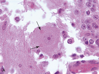 Figure 4-103