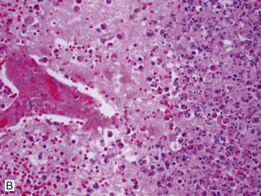 Figure 4-99