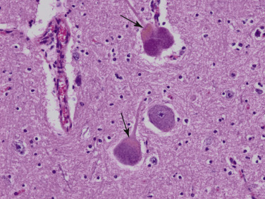Figure 4-43