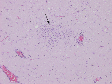 Figure 4-114