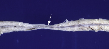 Figure 4-31