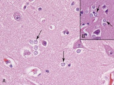 Figure 4-14