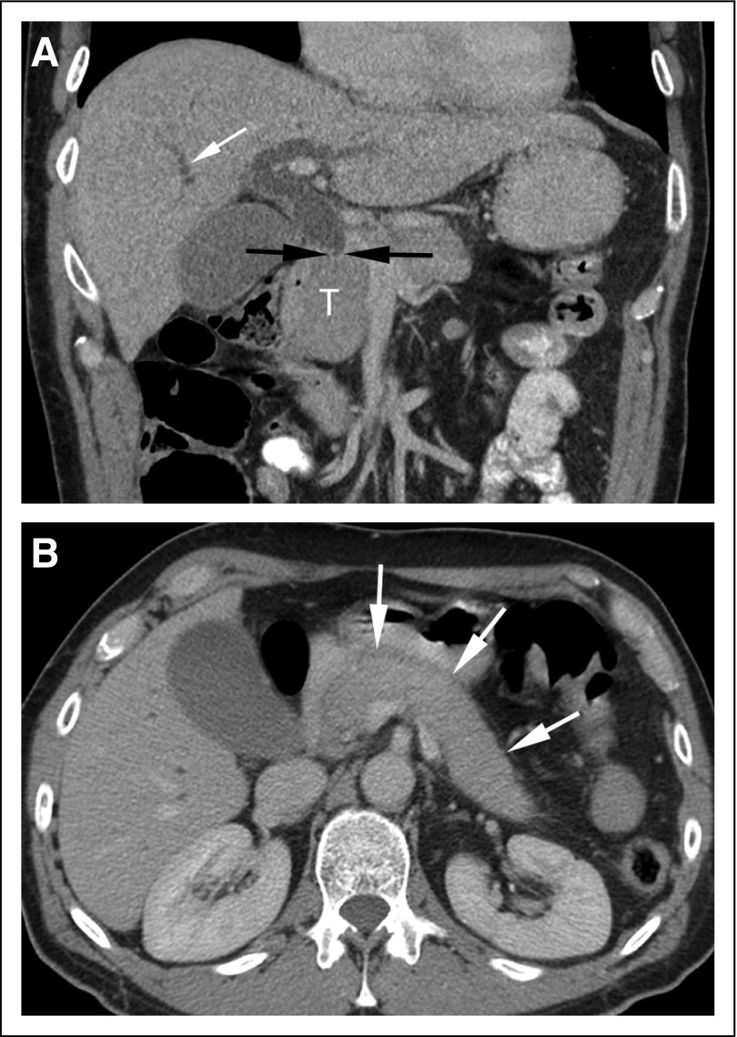 FIG 1.