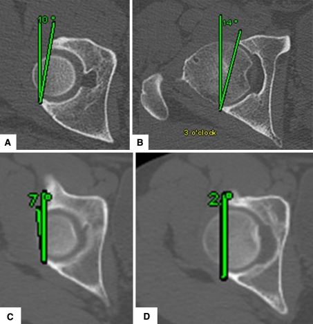 Fig. 2A–D