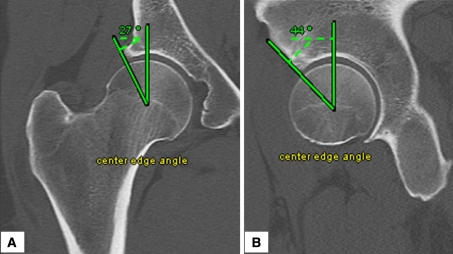 Fig. 1A–B