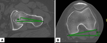 Fig. 5A–B