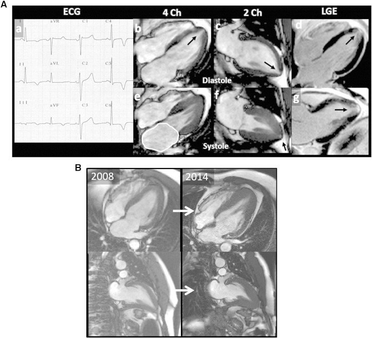 Fig. 1